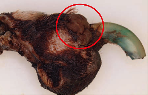 （2014）截趾术后的组织病理学诊断