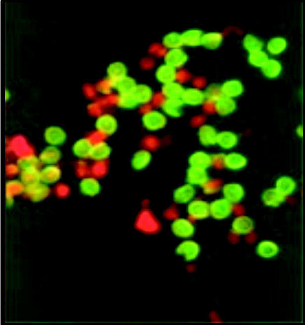 （2013）隐孢子虫 – 不仅是导致大动物腹泻的寄生虫